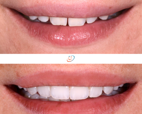 dentiste Mont-sur-Lausanne