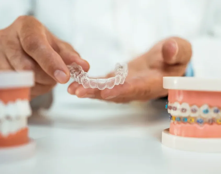D1 Dental Concept Clinique Dentaire - Dentistes & Hygiénistes - Gouttiere orthodontique bagues mont sur lausanne D1DentalConcept